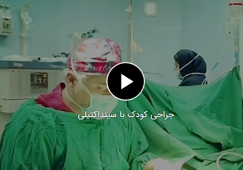 جراحی کودک با سینداکتیلی
