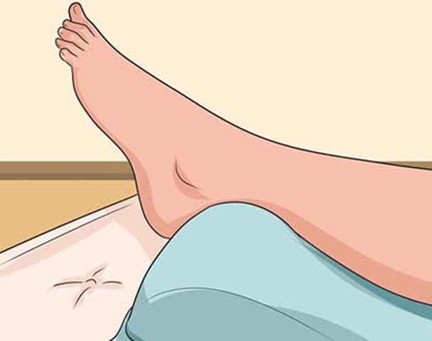 اقدامات لازم برای در رفتگی مچ پا