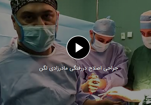 جراحی اصلاح دررفتگی مادرزادی لگن