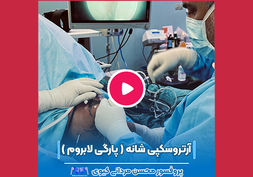 دررفتگی مکرر مفصل شانه