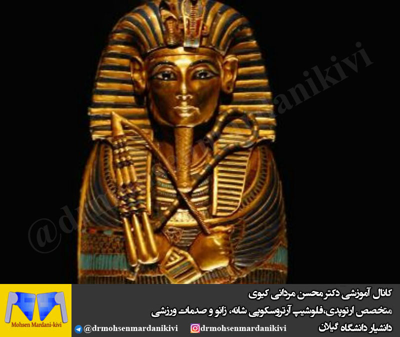 شاید فرعون مصر باستان اولین انسان غول‌پیکر بوده است !