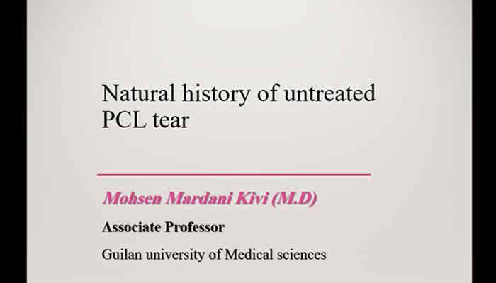 Natural history of untreated PCL tear