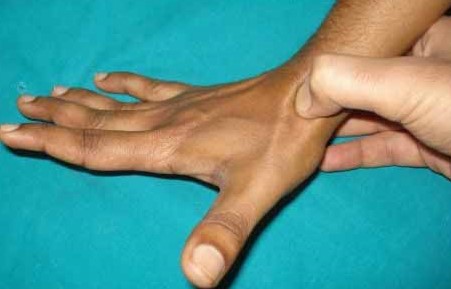 آناتومی سطحی دست