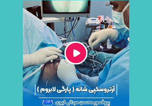 دررفتگی مکرر مفصل شانه