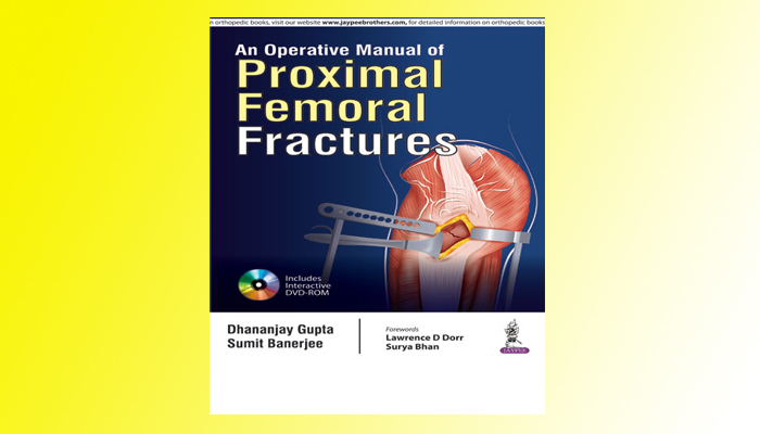  Proximal Femoral Fractures  