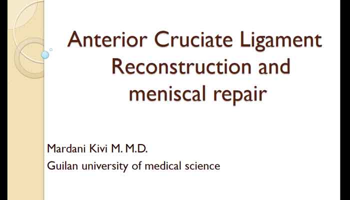 Anterior Cruciate Ligament Reconstruction and meniscal repair