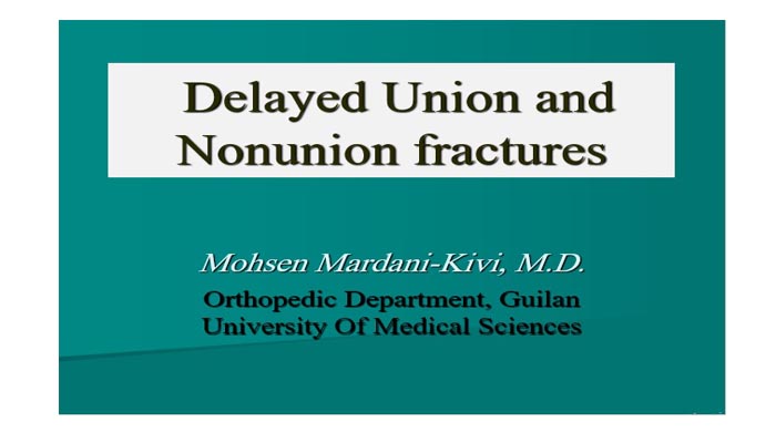  Delayed Union and Nonunion fractures