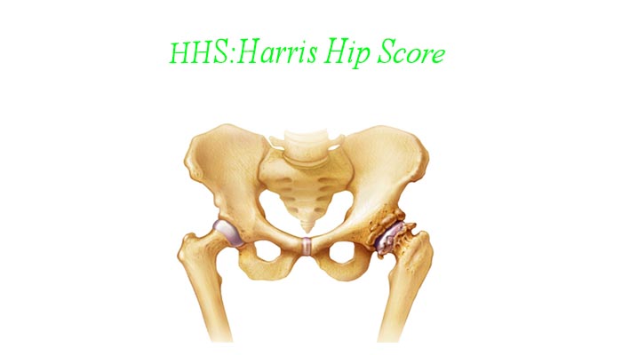 Harris Hip Score